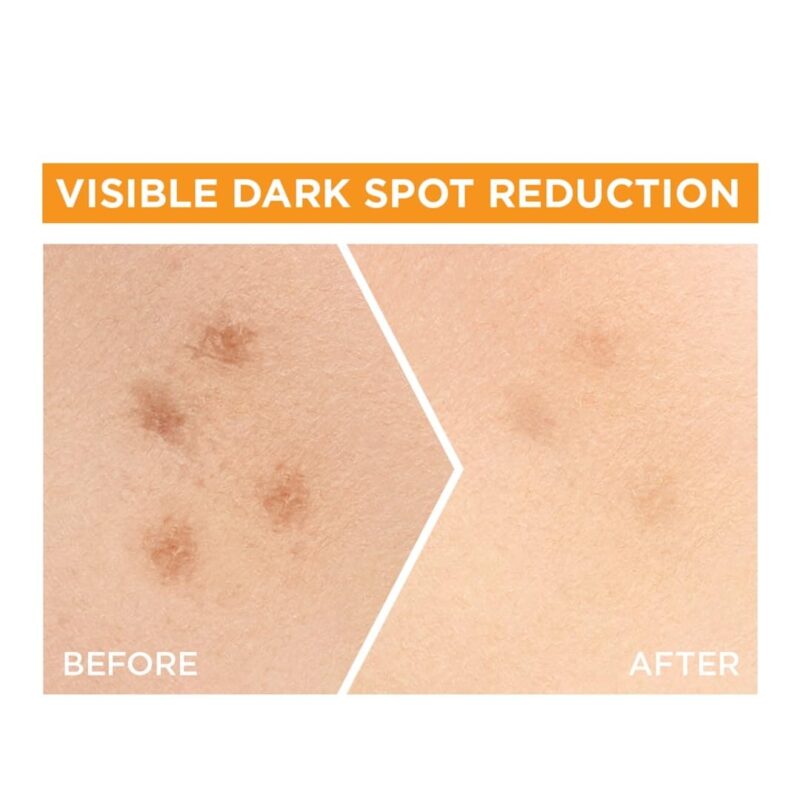 Garnier Light Complete Vitamin C Face Serum – 30X Booster for Glowing Skin, 30ml - Image 2